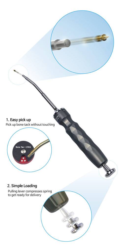 AUTO BONE TAC SYSTEM ( 3.5 mm )